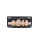 NOVO LIGN P VENEER POST 1W4 UPPER C3 4 pc ASST