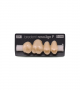 NOVO LIGN P VENEER POST 1W4 UPPER C4 4 pc ASST