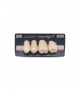 NOVO LIGN P VENEER POST G3 UPPER C1 4 pc ASST 24, 25, 26, 27