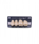 NOVO LIGN P VENEER POST G3 UPPER C3 4 pc ASST 24, 25, 26, 27