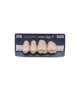 NOVO LIGN P VENEER POST G3 UPPER C3 4 pc