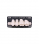 NOVO LIGN P VENEER POST G4 UPPER BL3 4 pc ASST 24, 25, 26, 27