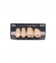 NOVO LIGN P VENEER POST G4 UPPER D2 4 pc ASST 24, 25, 26, 27