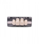 NOVO LIGN A VENEER ANT K53 UPPER A1 4 pc ASST 12, 11, 21, 22