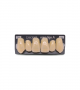 NOVO LIGN A VENEER ANT K53 UPPER D4 6 pc ASST 13, 12, 11, 21, 22, 23