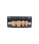 NOVO LIGN P VENEER POST G3 LOWER A4 4 pc