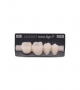 NOVO LIGN P VENEER POST 4W4 LOWER A1 4 pc ASST 44, 45, 46, 47
