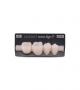 NOVO LIGN P VENEER POST 4W4 LOWER A1 4 pc ASST