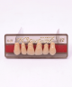 WIEDENT ESTETIC UPPER ANTERIORS SHADE A4