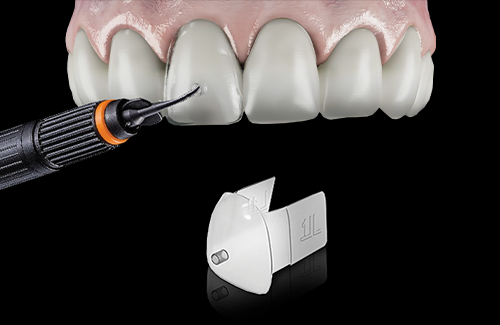 IPD Abutments